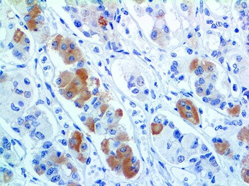 IHC of TSH BSB-56 on an FFPE Pituitary Tissue